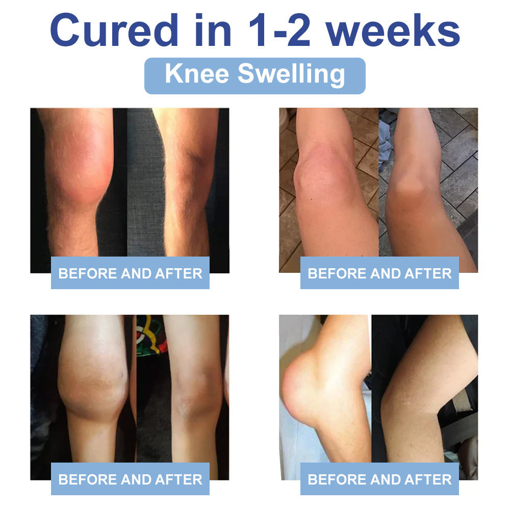 ✅Officially Recommended KUBOZN® Advanced Magnesium Pain Relief Cream (Treats Arthritis, Neuropathy, Rheumatism, Sports Injuries & More)