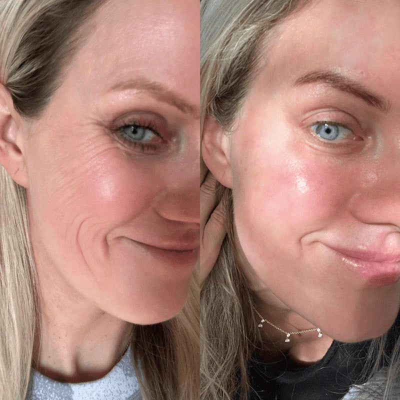 KUBOZN® GHK-Cu Microneedle Facial Patches
