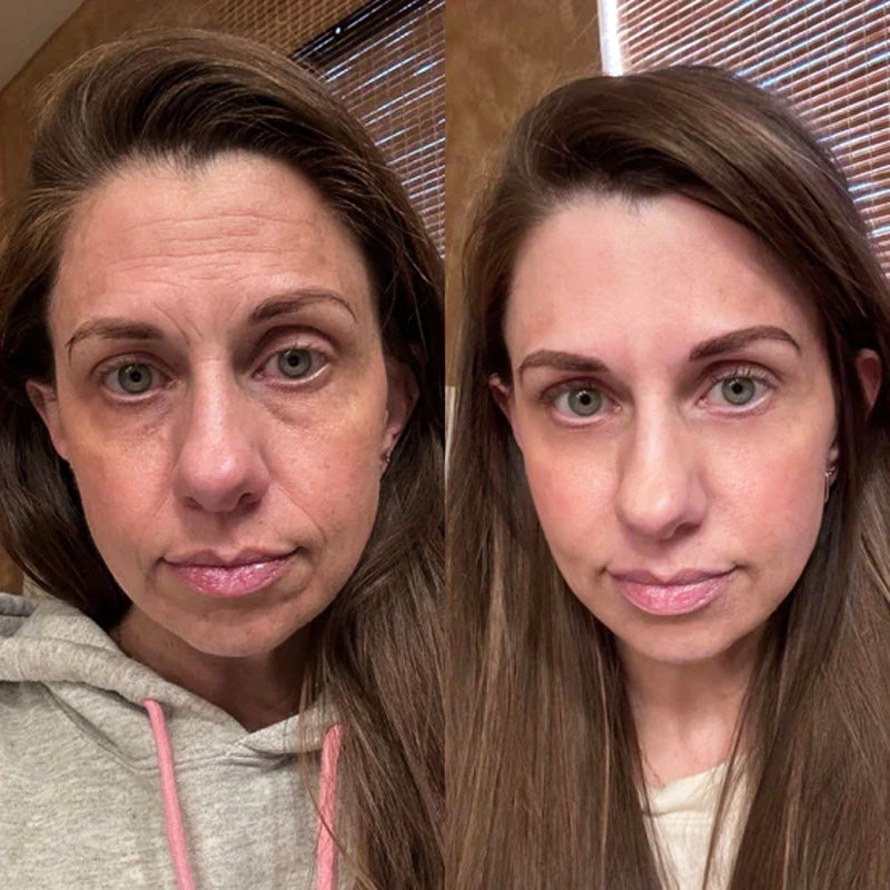 KUBOZN® GHK-Cu Microneedle Facial Patches