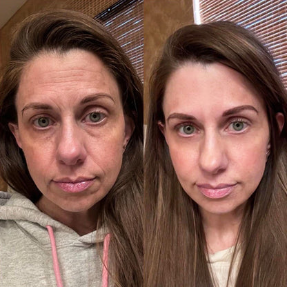 KUBOZN® GHK-Cu Microneedle Facial Patches