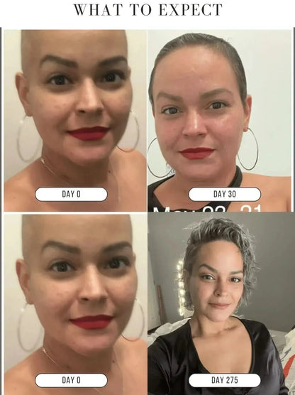 KUBOZN® Root Restore Hair Serum – Advanced Thickening & Nourishing Formula