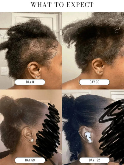 KUBOZN® Root Restore Hair Serum – Advanced Thickening & Nourishing Formula