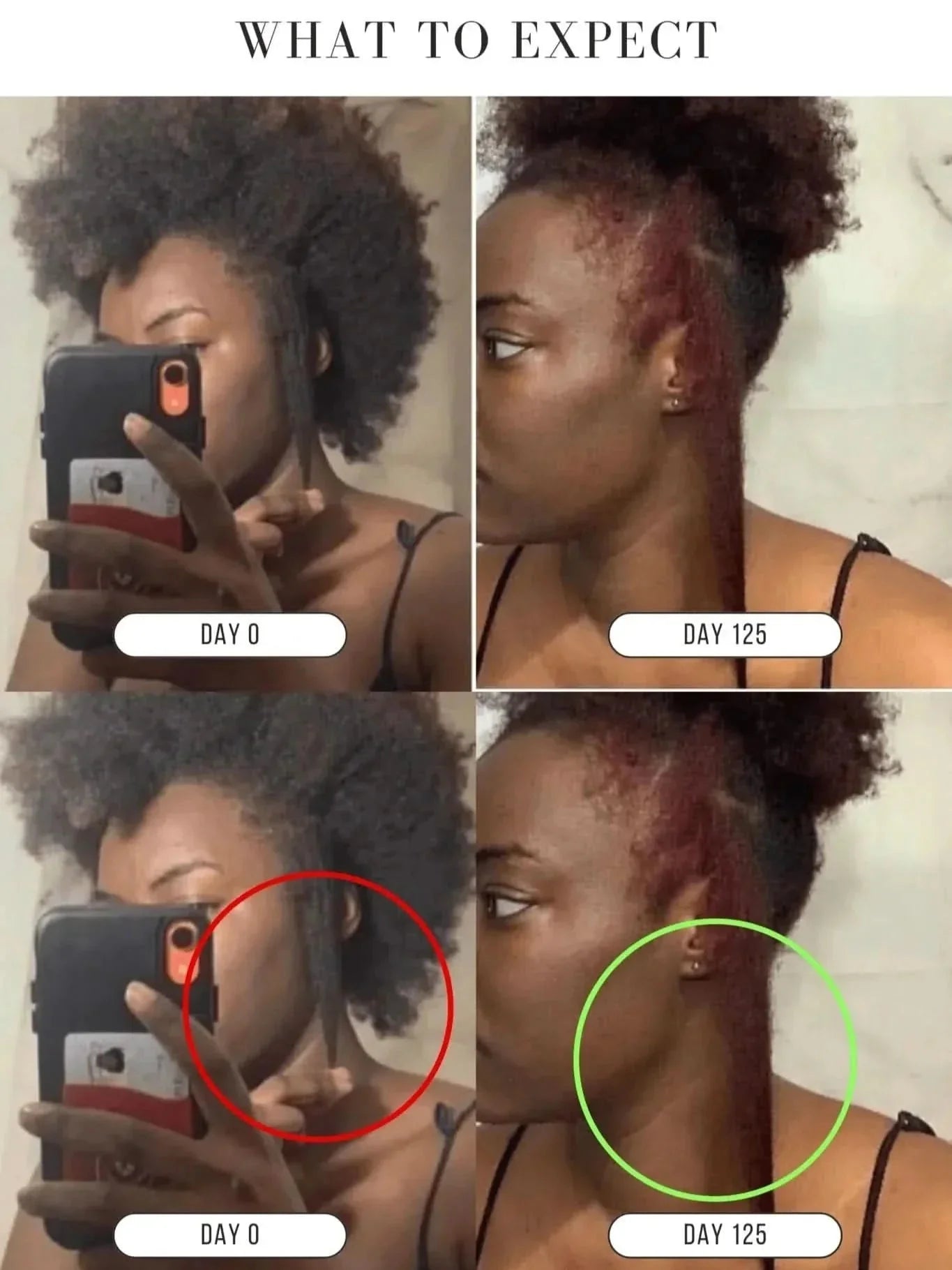 KUBOZN® Root Restore Hair Serum – Advanced Thickening & Nourishing Formula