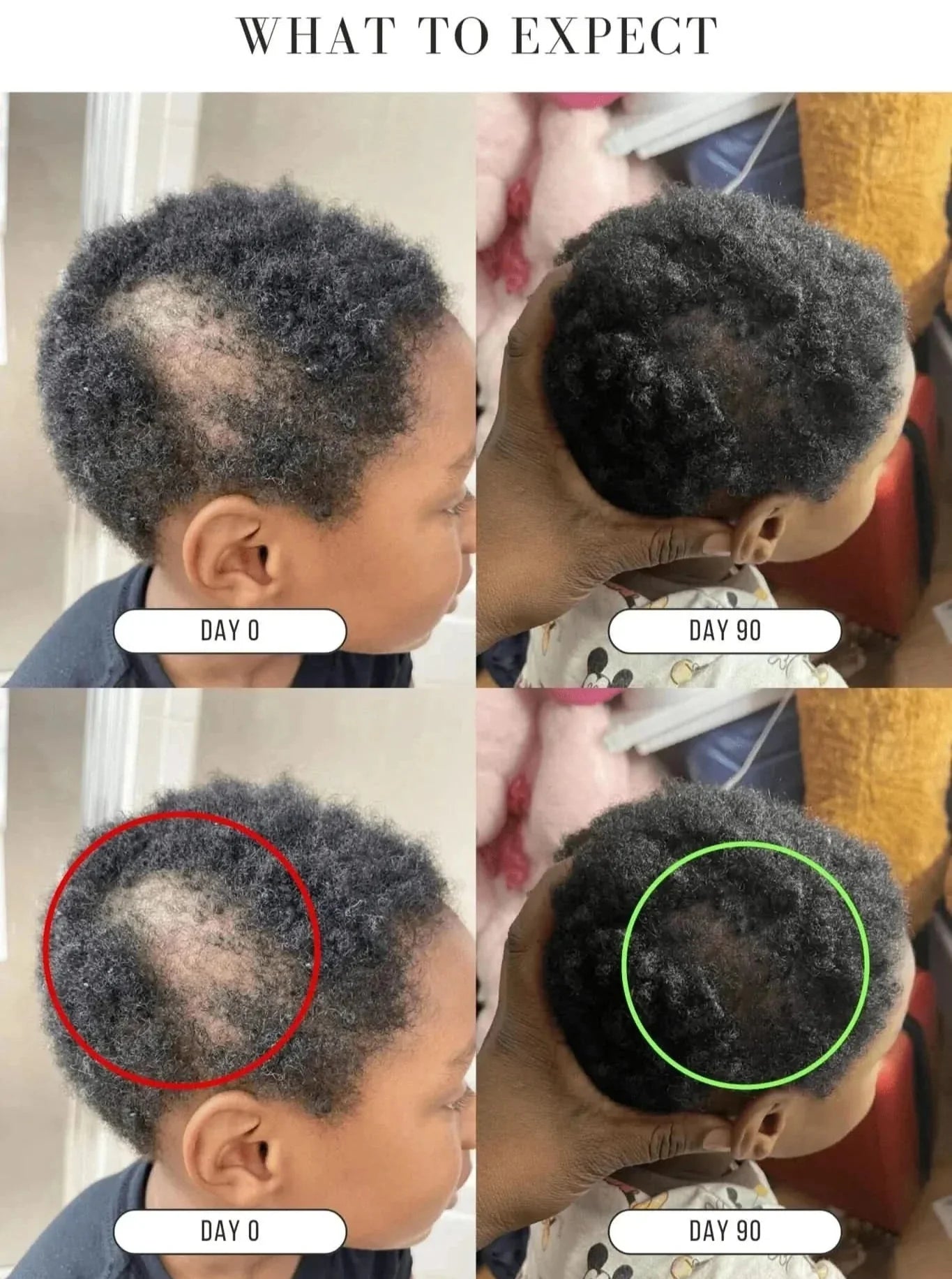 KUBOZN® Root Restore Hair Serum – Advanced Thickening & Nourishing Formula