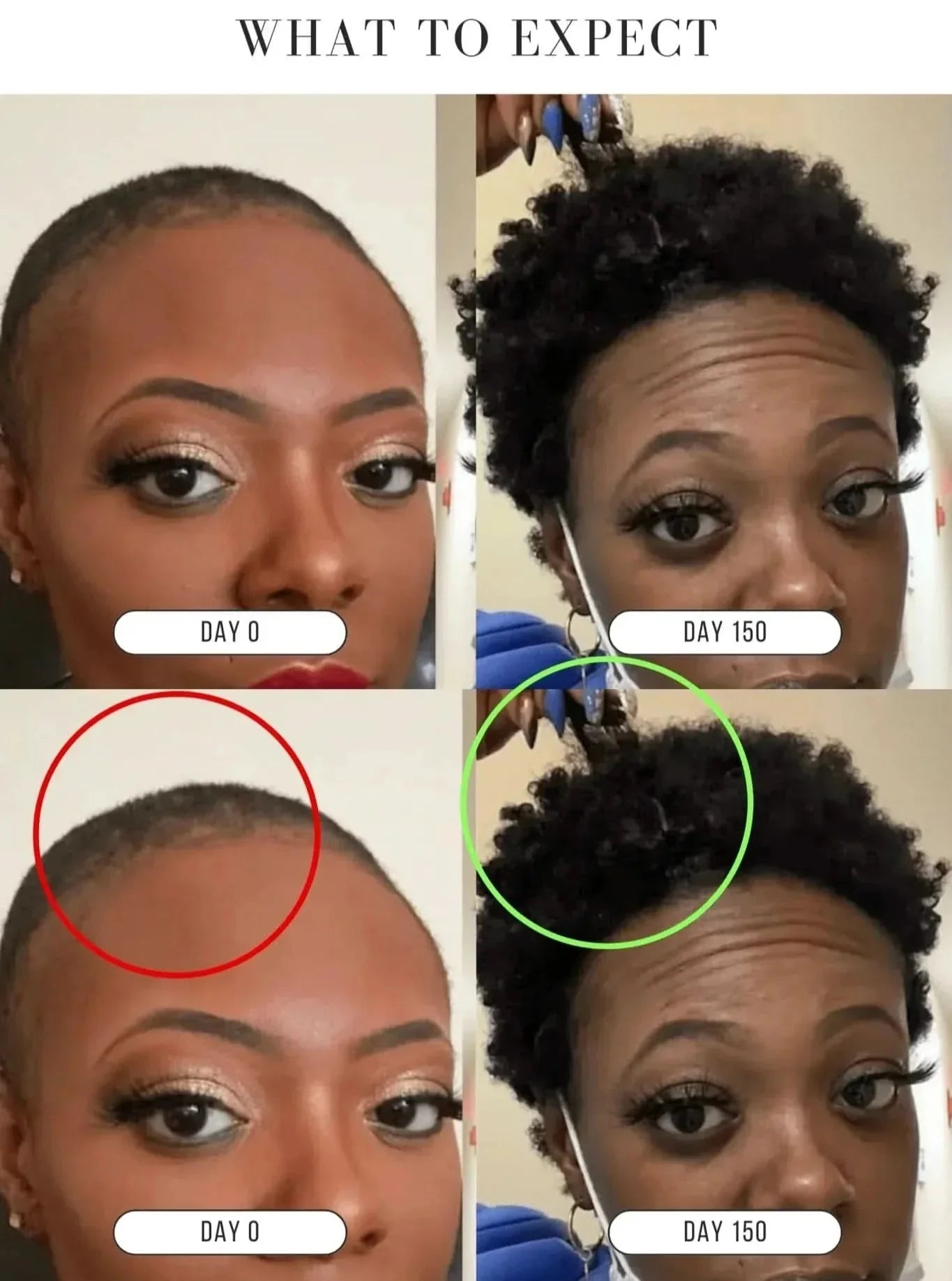 KUBOZN® Root Restore Hair Serum – Advanced Thickening & Nourishing Formula