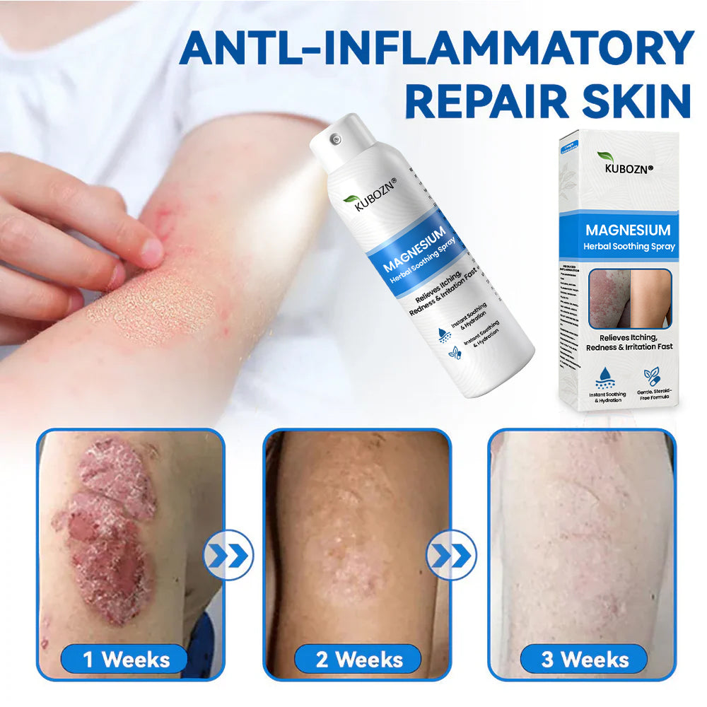 ✅  Official Store:KUBOZN® Magnesium Herbal Spray – Fast Relief for Psoriasis & Eczema | No-Rub, Steroid-Free