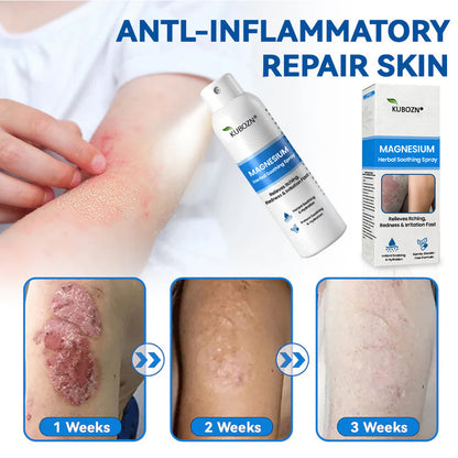 ✅  Official Store:KUBOZN® Magnesium Herbal Spray – Fast Relief for Psoriasis & Eczema | No-Rub, Steroid-Free