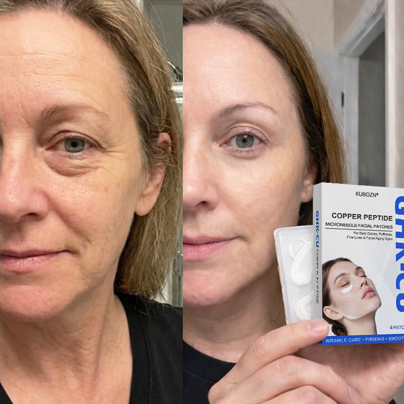 KUBOZN® GHK-Cu Microneedle Facial Patches (Offer)