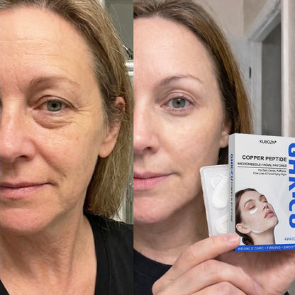 KUBOZN® GHK-Cu Microneedle Facial Patches (Offer)