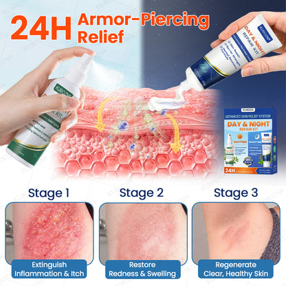 KUBOZN® Eczema Day & Night Repair System - 100% Steroid-Free Relief Duo for Intense Itch, Redness & Broken Skin