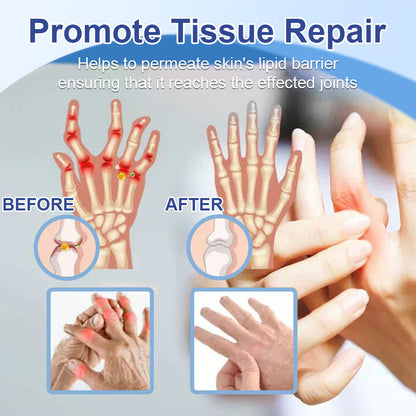 ✅Officially Recommended KUBOZN® Advanced Magnesium Pain Relief Cream (Treats Arthritis, Neuropathy, Rheumatism, Sports Injuries & More)