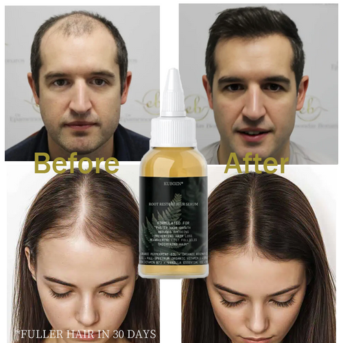 KUBOZN® Root Restore Hair Serum – Advanced Thickening & Nourishing Formula
