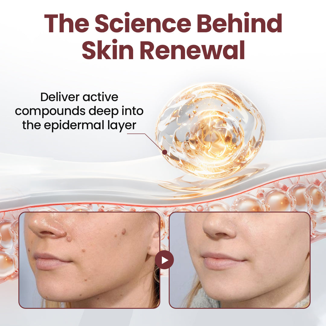⭐ KUBOZN® OryzaClear – Black Rice Power Cream for Skin Tags & Bumps · Gentle Plant-Based Softening Formula