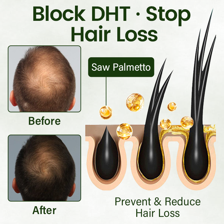 Cvreoz® Follicure BioGrow Hair Restoration Spray ( Reawaken Your Roots. Regrow Naturally. ✨ Clinically Proven Hair Regrowth Within 4 Weeks ✨) (offer)