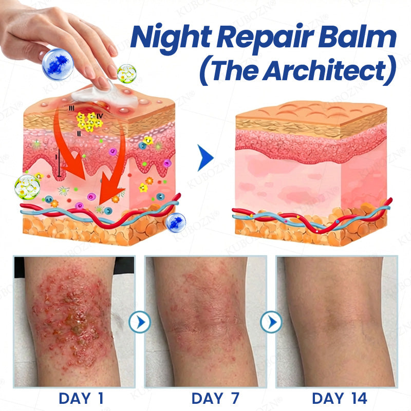 KUBOZN® Psoriasis Day & Night Repair System - 100% Steroid-Free Relief Duo for Plaques, Scaling & Itch
