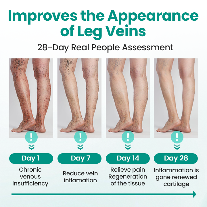KUBOZN® LegRenew Varicose Veins Patch