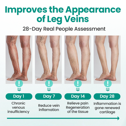 KUBOZN® LegRenew Varicose Veins Patch