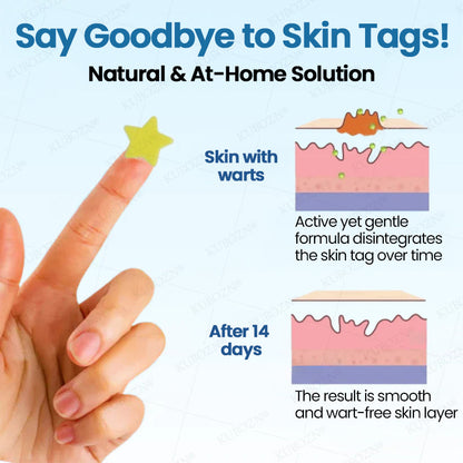✨KUBOZN® Pro MicroDarts Star Patch – Painless, Fast & Effective Skin Tag Removal