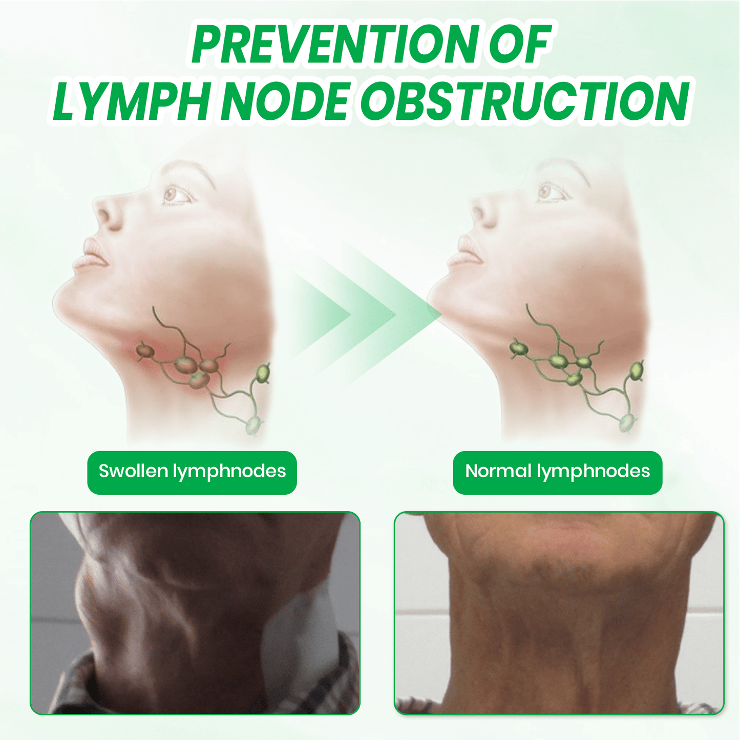 KUBOZN® Lymphatic Detox Herbal Cream