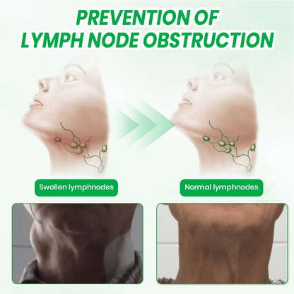 KUBOZN® Lymphatic Detox Herbal Cream