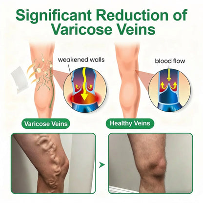 👨‍⚕️🔥Healrize® VeinEase Microneedle Care Patch⚡Instant Relief, Long-Term Results